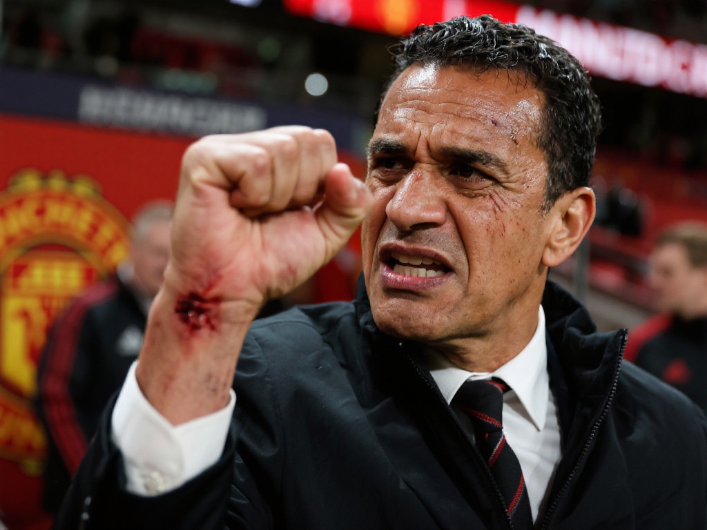 伤痕背后是否折射管理矛盾
谈及阿莫林拳